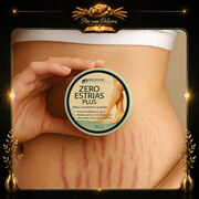 Creme Zero Estrias Plus